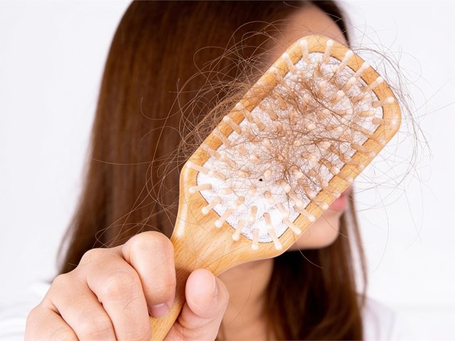 5 preguntas frecuentes sobre la caída del cabello que responden nuestros peluqueros en Vigo